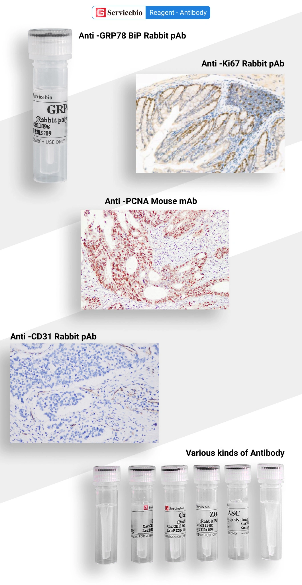 Anti -CD27 Rabbit Polyclonal Primary Antibodies