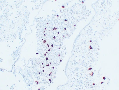 Adrenocorticotropin Mouse Monoclonal Anti-ACTH Antibody