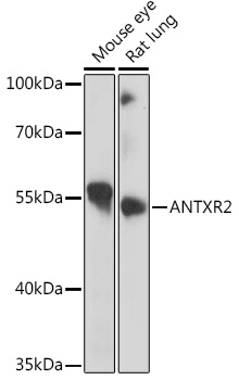Antxr2 ポリクローナル抗体